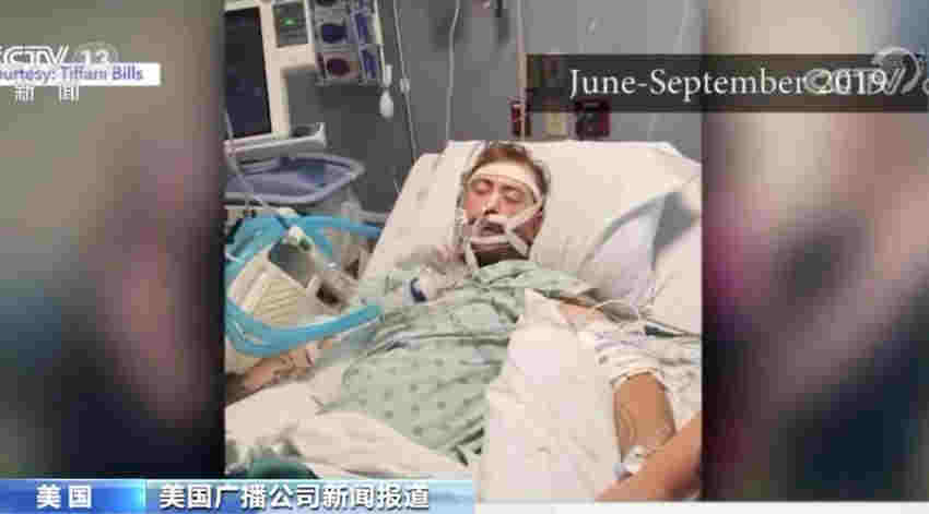 電子煙增大新冠