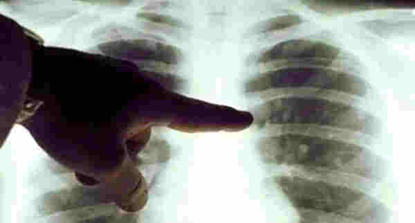 電子煙又出事了！贛州警方依法刑拘4人