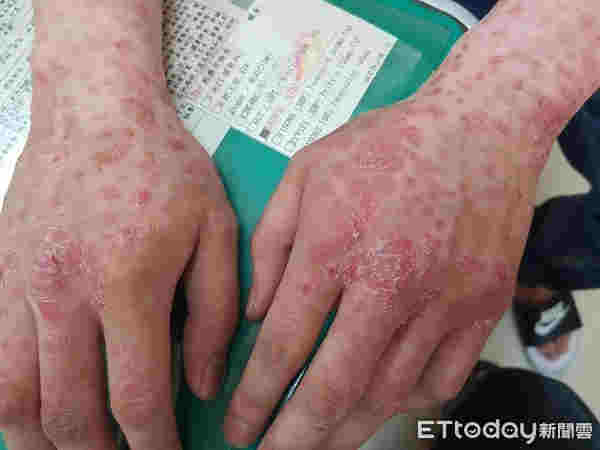 臺灣媒體讓電子霧化煙看起來比吸煙更危險 